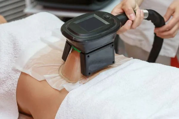 Image of person having fat freezing treatment to help weight gain Ilkeston