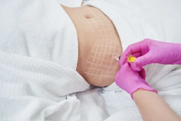 image of fat dissolving injections on love handles to help combat weight gain Ilkeston