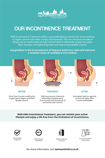 image of how urge incontinence Ilkeston treatment works