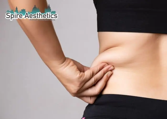 Image of woman pinching fat on their hips Ilkeston. Fat Freezing treatment