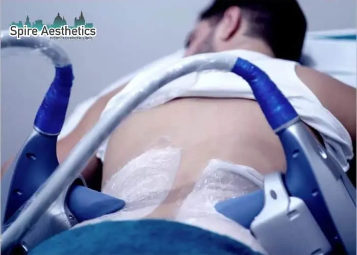 Man having fat freezing treatment done on love handles before a competitions Ilkeston to create a sculpted look.